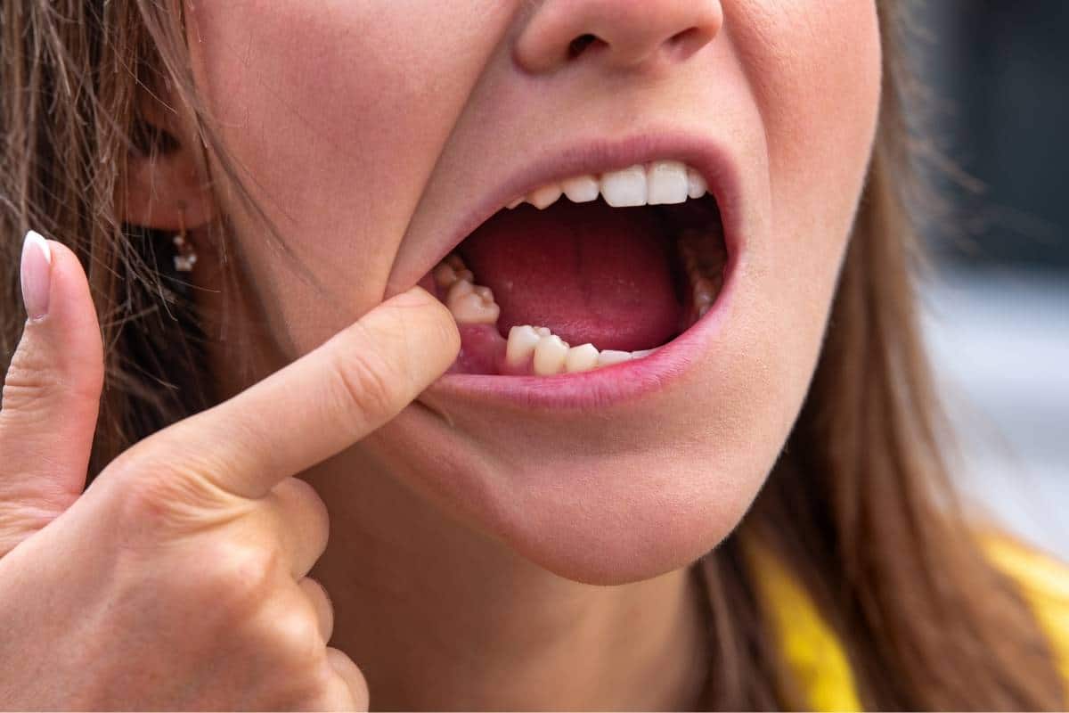 Close-up of person pointing to painful molar area, indicating possible hidden dental problem not yet visible without X-ray